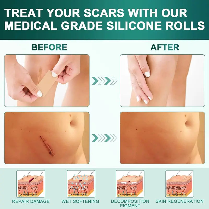 Premium Silicone Scar Sheets