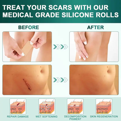 Premium Silicone Scar Sheets