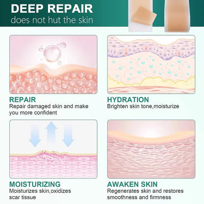 Premium Silicone Scar Sheets