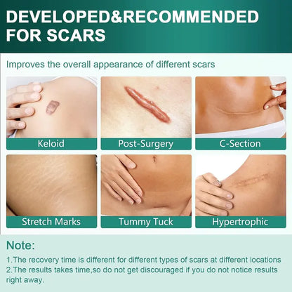 Premium Silicone Scar Sheets